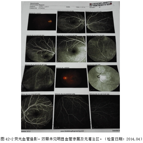 ZY016_234_1.gif